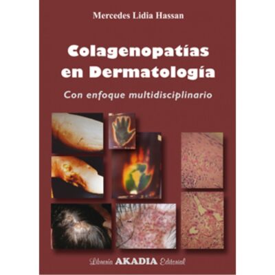COLAGENOPATÍAS EN DERMATOLOGÍA