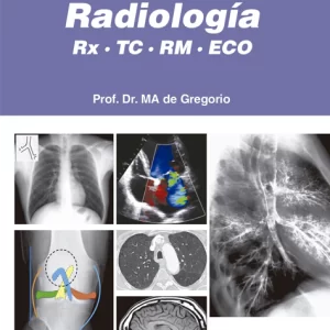 POCKET DE RADIOLOGÍA
