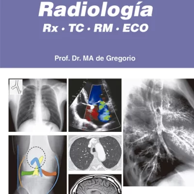 POCKET DE RADIOLOGÍA