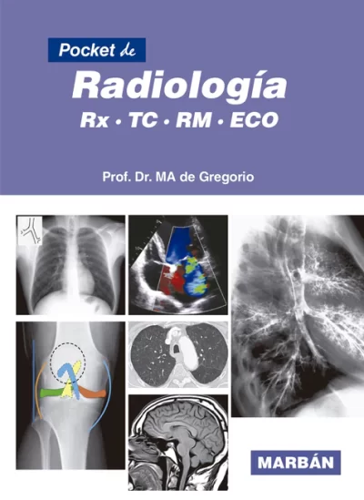 POCKET DE RADIOLOGÍA