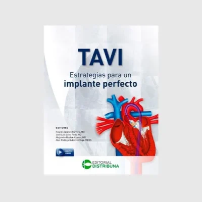 TAVI: estrategias para un implante perfecto